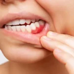 4 receitas práticas e deliciosas com aspargo