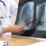 Especialistas alertam para golpes em ressarcimentos do Banco Master