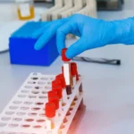 Câmara aprova projeto que cria o Sistema Nacional de Educação, o ‘SUS da Educação’