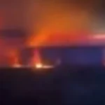 Antes e Depois: Influencer perde 150 kg e retira 7 kg de excesso de pele