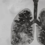 Novo Mercedes-Benz Classe E elétrico é flagrado com visual reformulado