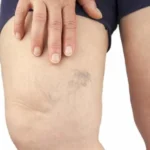 Escândalo de corrupção derruba braço-direito de Zelenski na Ucrânia