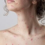 Milhares de agricultores bloqueiam Bruxelas contra acordo com Mercosul