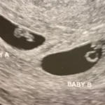 Quatro bancadas da Câmara acionam STF contra PL da Dosimetria