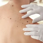 Copa Super 8 tem histórico de zebras e queda de favoritos