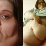 Bilionário morre em cirurgia para aumento do pênis; cirurgião é condenado