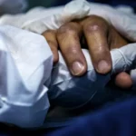 Doenças estranhas com sintomas mais esquisitos ainda