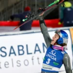 A doença que impede os famosos de comer alimentos comuns