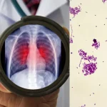 Fundos investem pesado e colocam a computação quântica na briga para ser a “próxima IA”